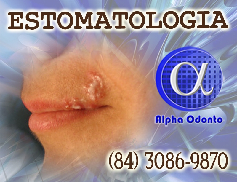 ESTOMATOLOGIA ESPECIALIZADA - (84) 3086-9870