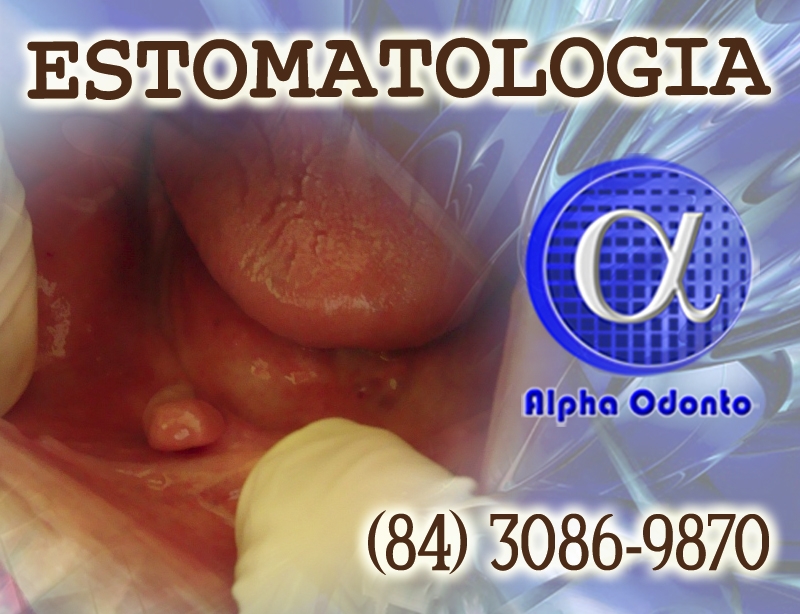 ESTOMATOLOGIA ESPECIALIZADA - (84) 3086-9870