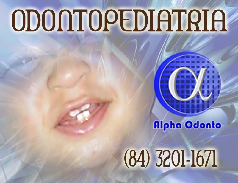 ODONTOBABY ESPECIALISTA EM NATAL - (84) 3086-9870