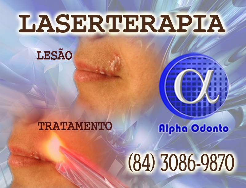 LASERTERAPIA ORAL EM NATAL - ALPHA ODONTO - (84) 3086-9870