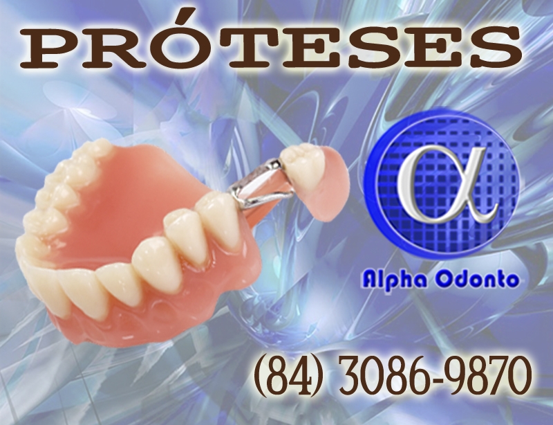 PRÓTESES DENTÁRIAS EM NATAL - ALPHA ODONTO CLÍNICA - (84) 3086-9870