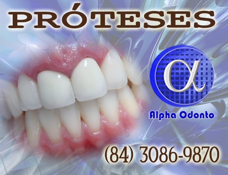 PRÓTESES DENTÁRIAS EM NATAL - ALPHA ODONTO CLÍNICA - (84) 3086-9870