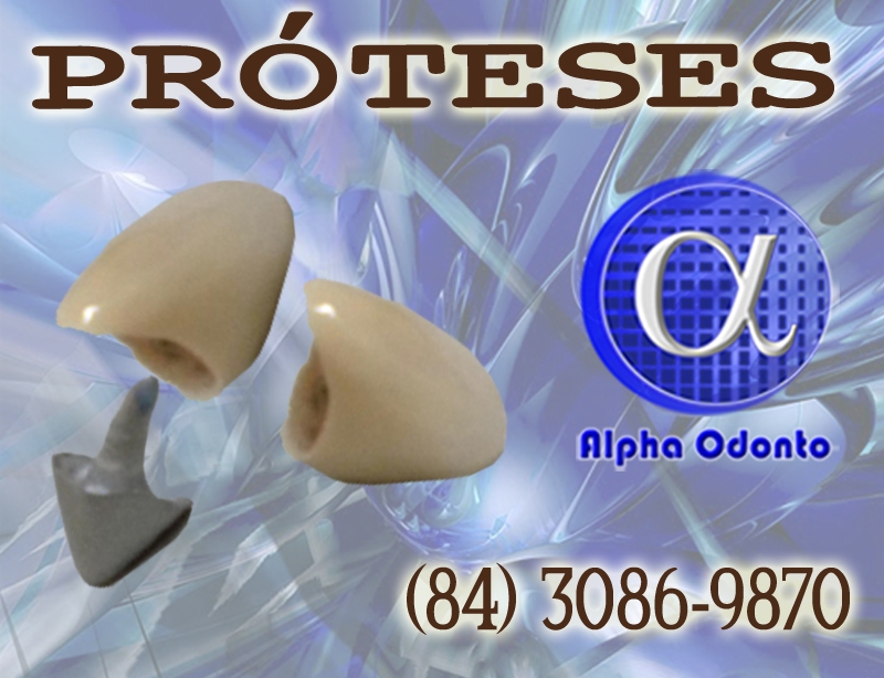 PRÓTESES DENTÁRIAS EM NATAL - ALPHA ODONTO CLÍNICA - (84) 3086-9870