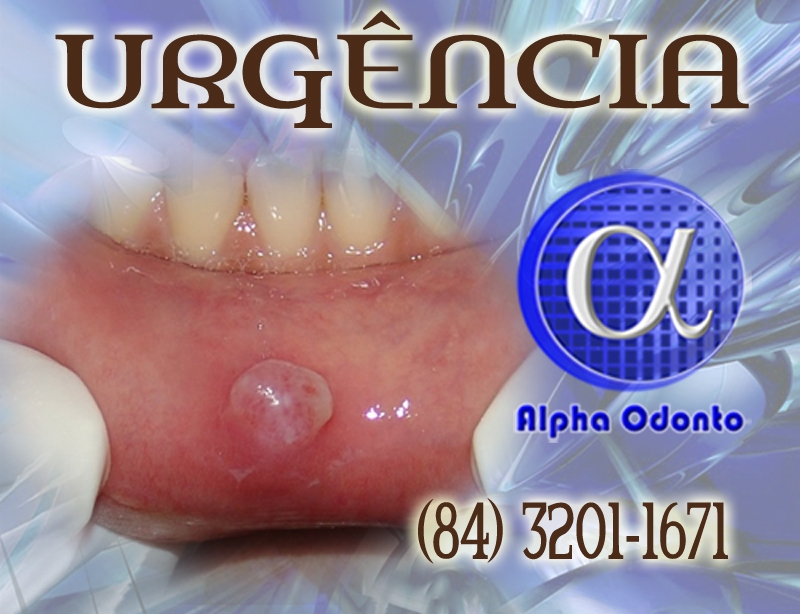 URGÊNCIA ODONTOLÓGICA EM NATAL - ALPHA ODONTO - (84) 3086-9870