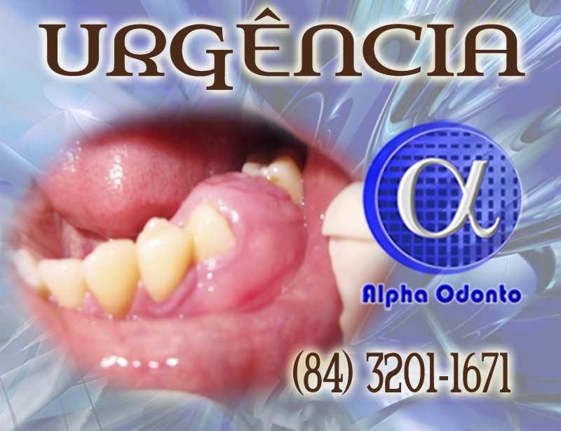 URGÊNCIA ODONTOLÓGICA EM NATAL - ALPHA ODONTO - (84) 3086-9870