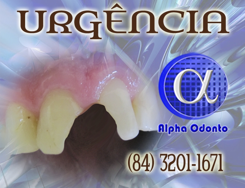 URGÊNCIA ODONTOLÓGICA EM NATAL - ALPHA ODONTO - (84) 3086-9870