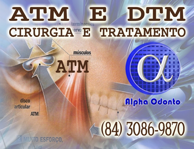 ATM & DTM - CIRURGIA E TRATAMENTO -  (84) 3086-9870