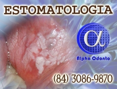 Estomatologia em natal - alpha odonto clnica - (84) 3086-9870