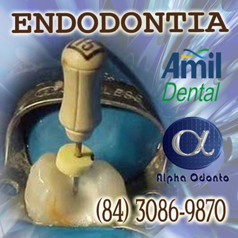 ENDODONTIA AMIL DENTAL NATAL - (84) 3086-9870