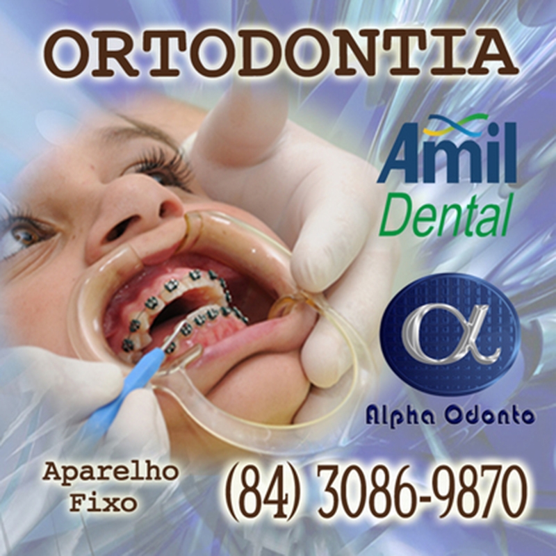 ORTODONTIA AMIL DENTAL NATAL - (84) 3086-9870