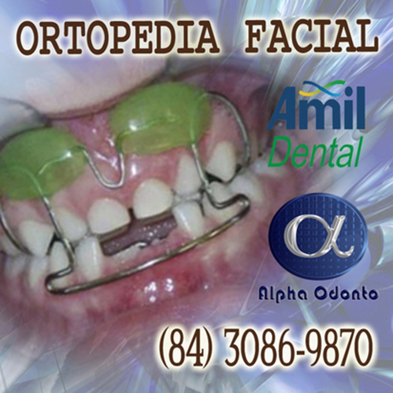 ORTOPEDIA FACIAL AMIL DENTAL NATAL - (84) 3086-9870