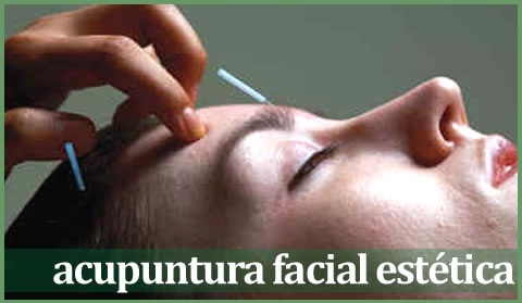 Acupuntura Facial Esttica