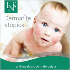 Tratamento de dermatite atópica,