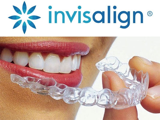 Invisalign Uberlandia