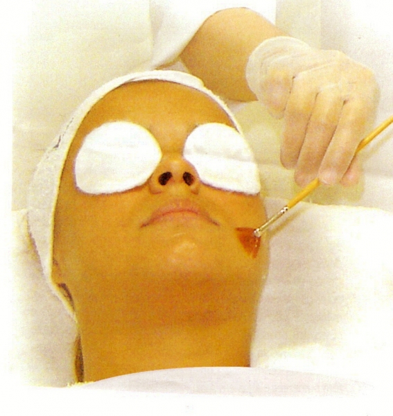 PEELINGS: Acne Peel, Vinho, Ácido Glicólico, AHAS, kójico, Fítico, Aqua peel, etc..