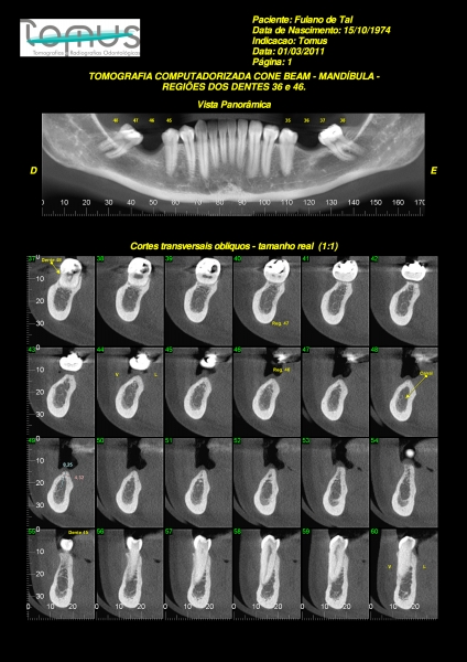 Tomografia Cone Beam realizada na Tomus