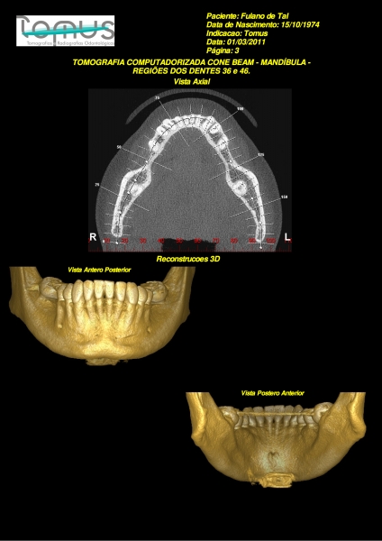 Tomografia Cone Beam realizada na Tomus