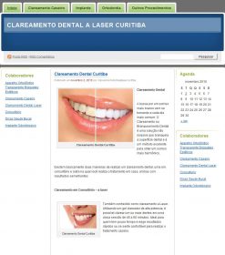 Clareamento Dental a Laser Curitiba