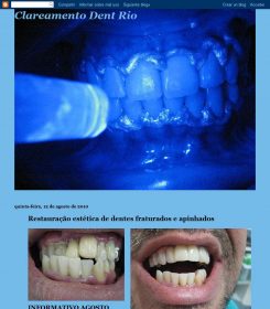 Dentistas Próximo À 28 de Setembro - Vila Isabel - Rj (21) 3936-8037